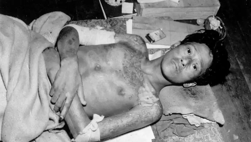 80 Yılda Değişmeyen Tehdit: Nagasaki’den Nükleer Felaket Uyarısı